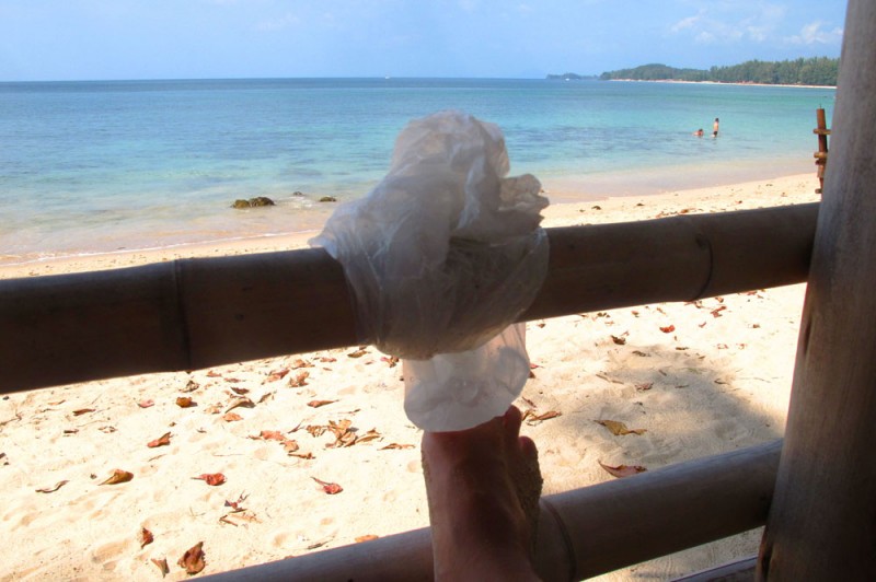 Icing my toe in Koh Lanta Icing my toe in Koh Lanta